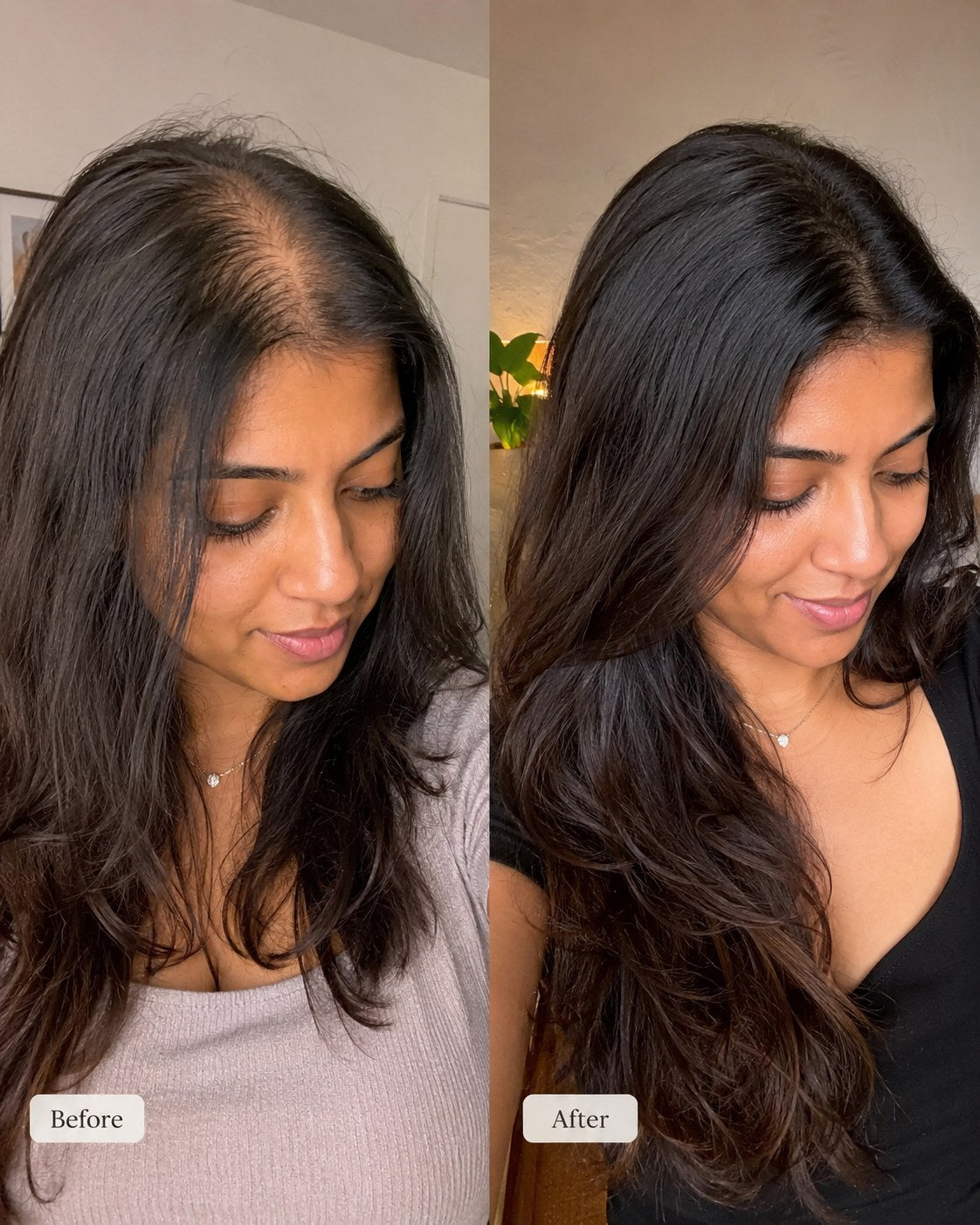 Before and after hair progress image 2