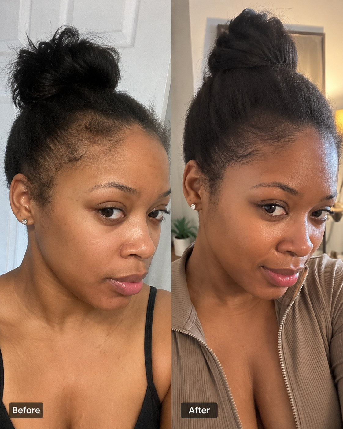 Before and after hair progress image 3
