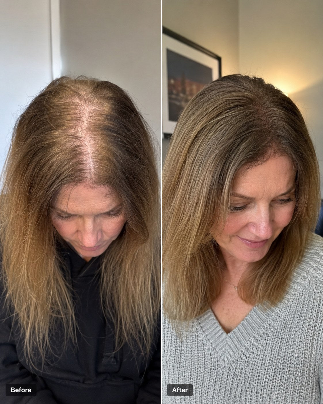 Before and after hair progress image 4