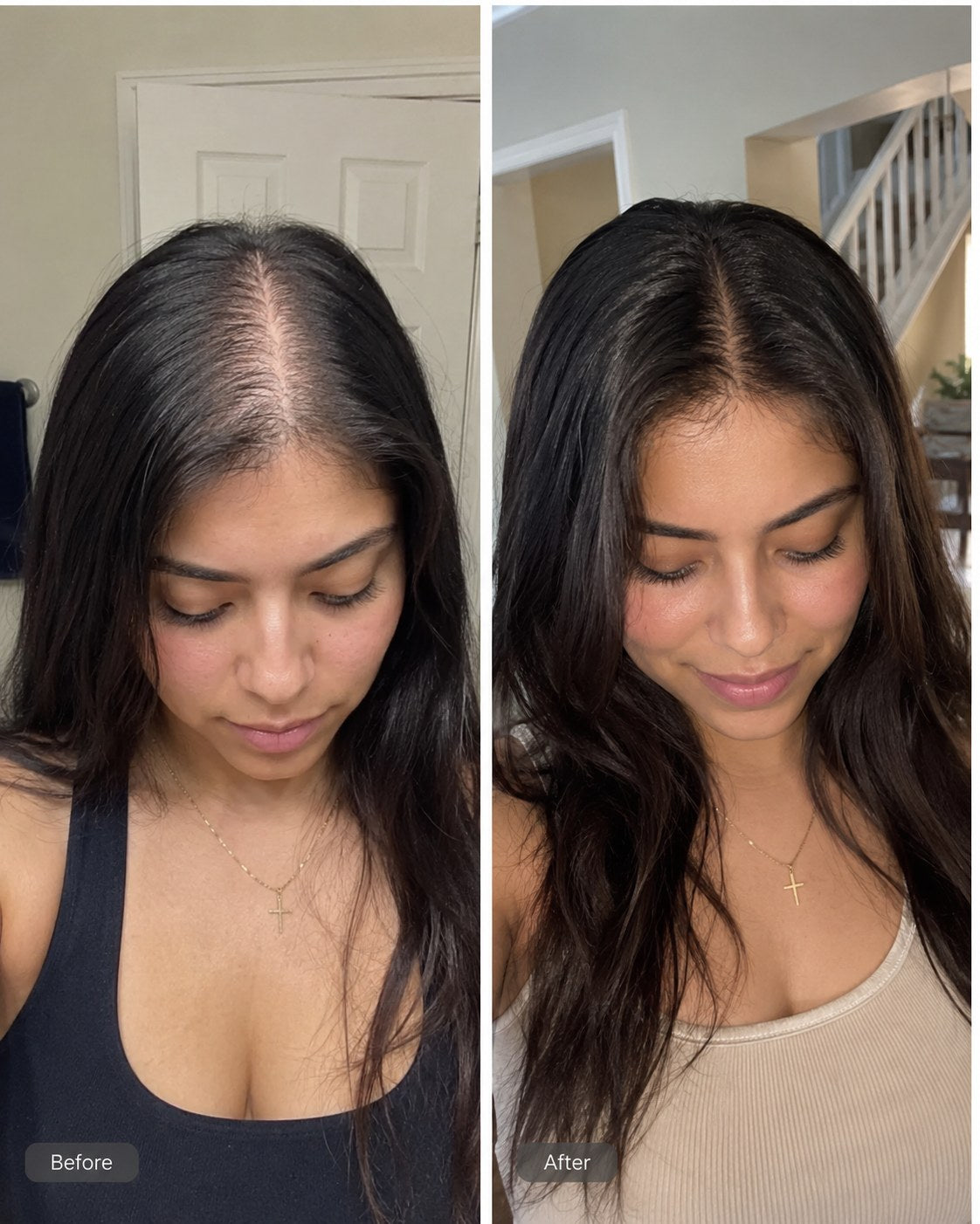 Before and after hair progress image 5