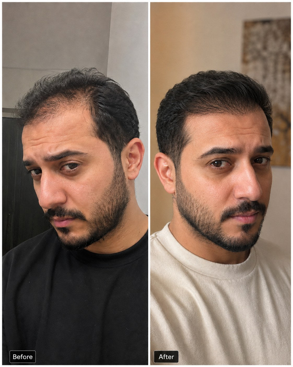 Before and after hair progress image 6