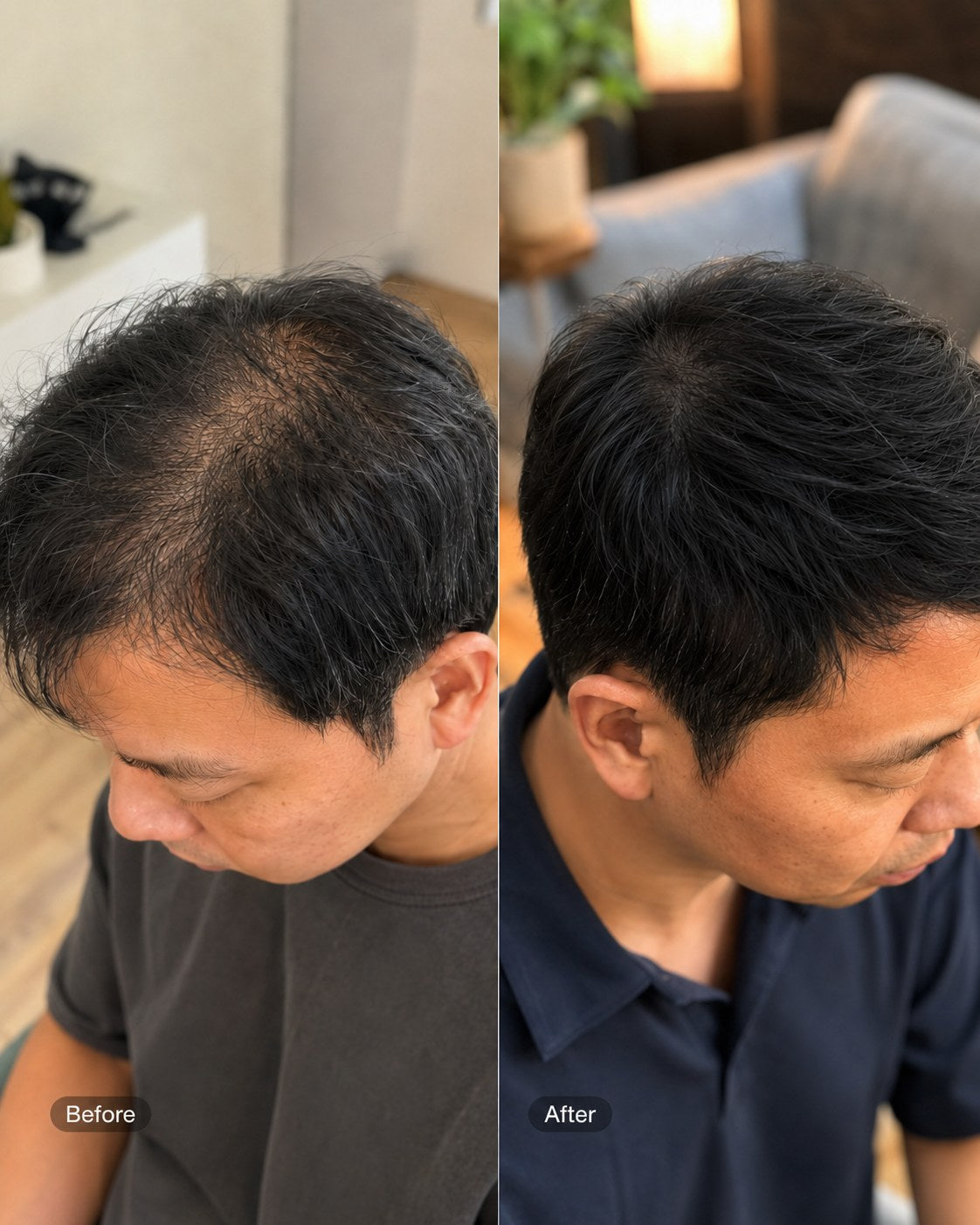 Before and after hair progress image 7