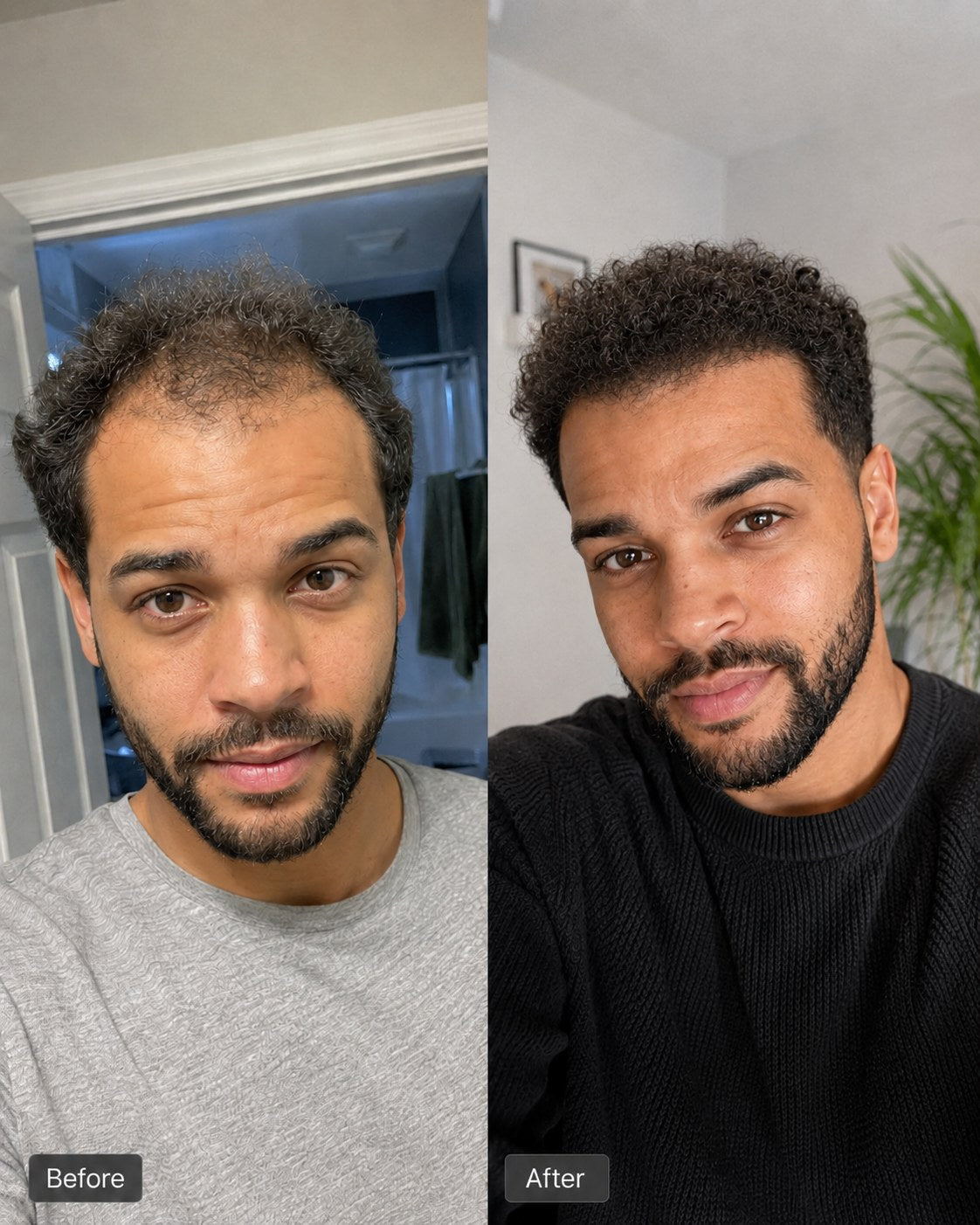 Before and after hair progress image 8